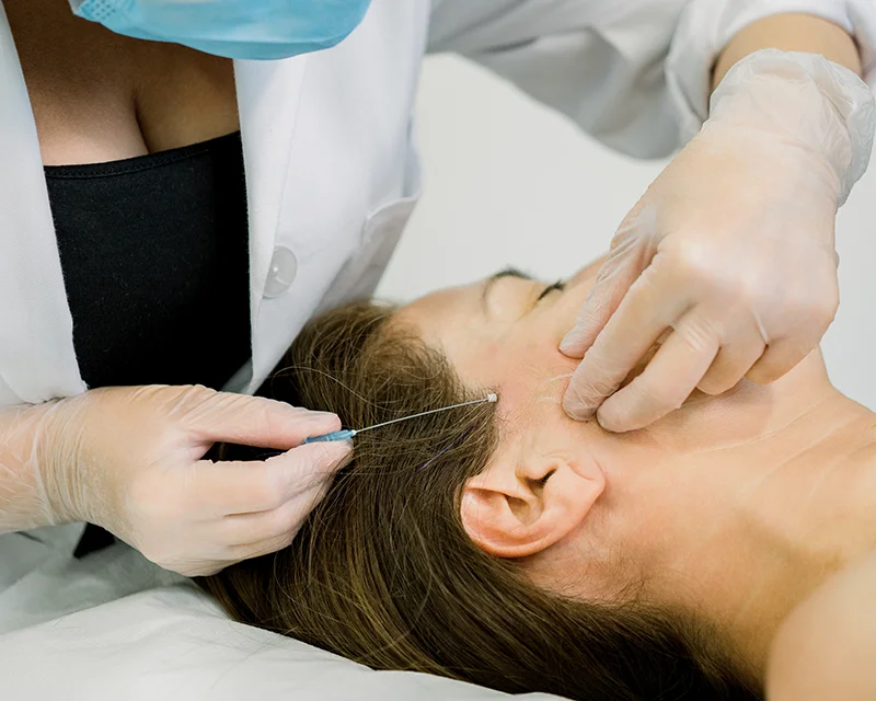 Cosmetic procedure using tensor threads at a clinic